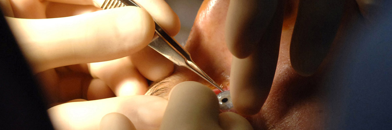 Eye instruments